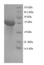 SDS-PAGE