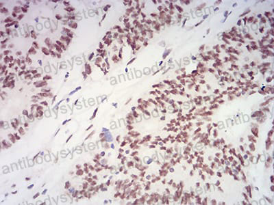 Валидация AntibodySystem RHK75501