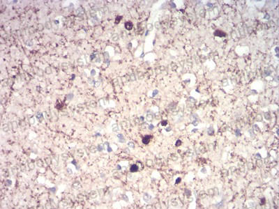 Валидация AntibodySystem RHD53405