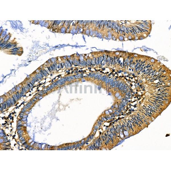 Валидация Affinity DF6210 - 17478