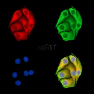 Валидация Affinity DF15028 - 11241