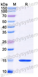 Валидация SDS-PAGE - AntibodySystem RXX00906