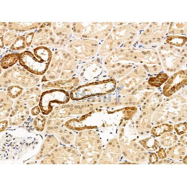 Валидация Affinity DF13660 - 9224