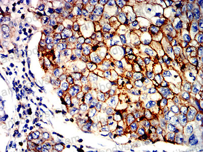 Валидация AntibodySystem RHD69204 (1725)