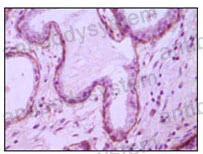 Валидация AntibodySystem RHC33003