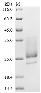 SDS-PAGE