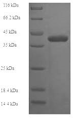 SDS-PAGE