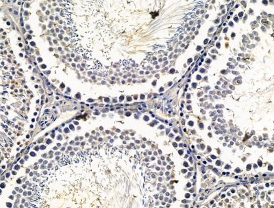 Валидация Affinity DF15609 - 12037