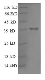 SDS-PAGE