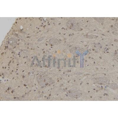 Валидация Affinity DF8358 - 20218