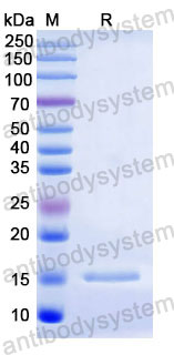 Валидация SDS-PAGE - AntibodySystem RHD58801