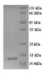 SDS-PAGE
