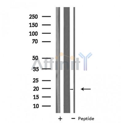 Валидация Affinity DF4194 - 15549
