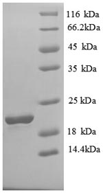 SDS-PAGE