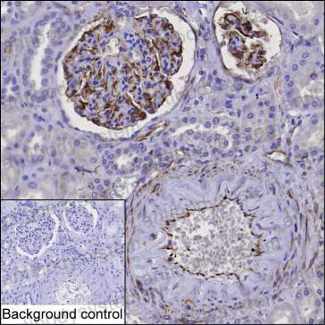 Валидация AntibodySystem RHF66402 (2639)
