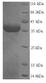 SDS-PAGE