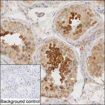 Валидация AntibodySystem RHP06101