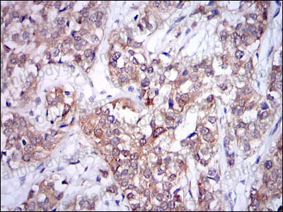 Валидация AntibodySystem RHF60802