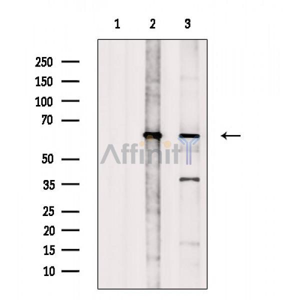 Валидация Affinity DF2462 - 13092