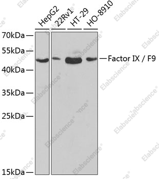 Вестерн-блоттинг, Factor IX / F9, различные клеточные линии