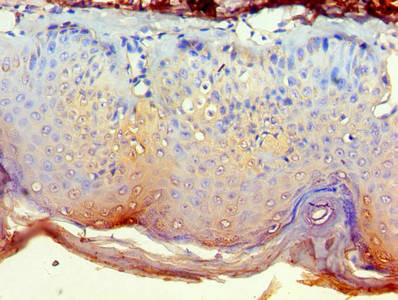 Валидация AssayVector ARM1344(944)