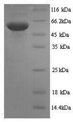 SDS-PAGE