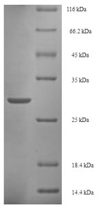 SDS-PAGE