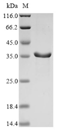 SDS-PAGE
