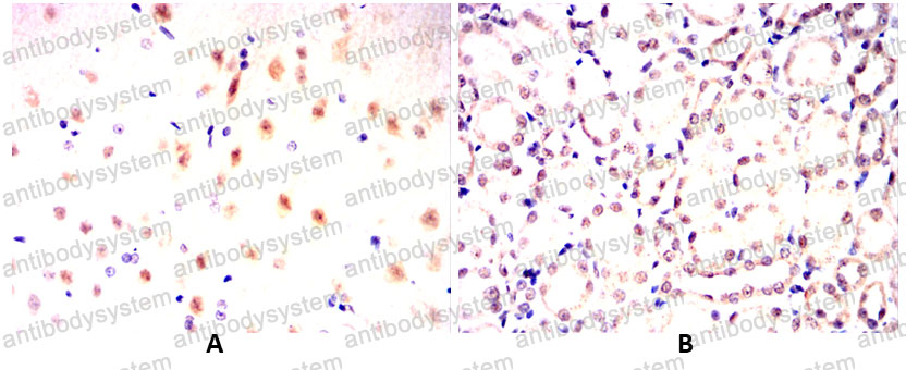 Валидация AntibodySystem RHF02504