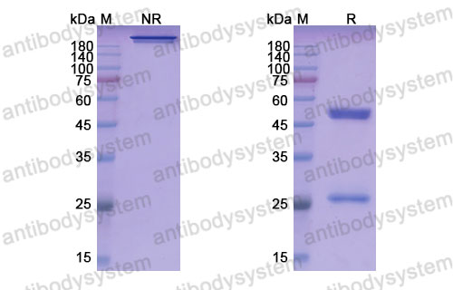 Валидация SDS-PAGE - AntibodySystem DVV00312