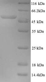 SDS-PAGE