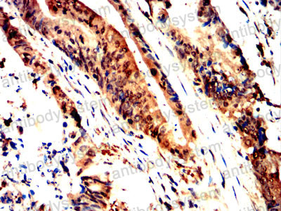 Валидация AntibodySystem RHA19201
