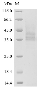 SDS-PAGE