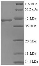 SDS-PAGE