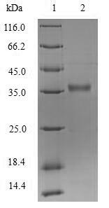 SDS-PAGE