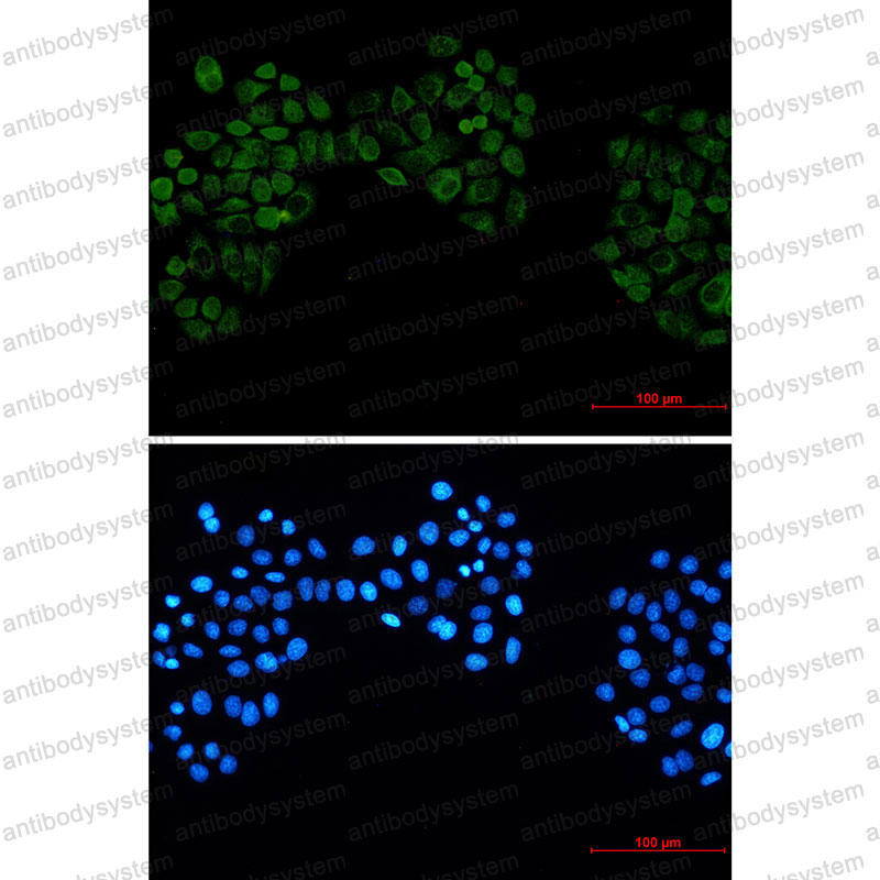 Валидация IF - AntibodySystem RHF61501