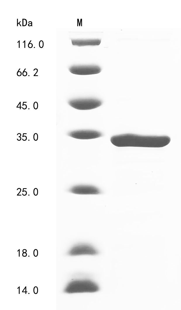 SDS-PAGE
