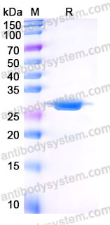 YHB75501, SDS-PAGE