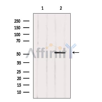 Валидация Affinity AF6027 - 3222