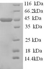 SDS-PAGE