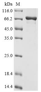 SDS-PAGE
