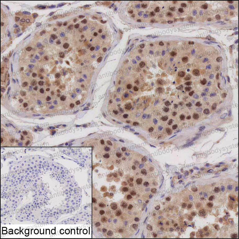 Валидация AntibodySystem RHP08001