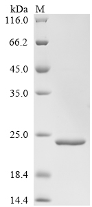 SDS-PAGE