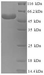SDS-PAGE