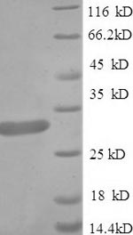 SDS-PAGE