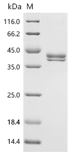 SDS-PAGE