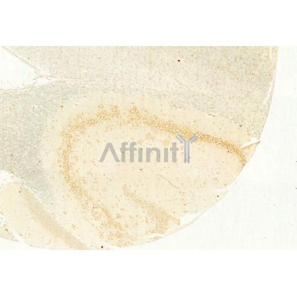 Валидация Affinity AF5362 - 2974