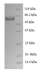 SDS-PAGE