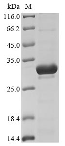 SDS-PAGE