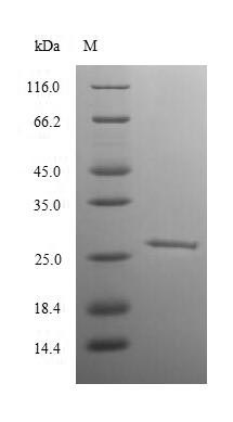 SDS-PAGE
